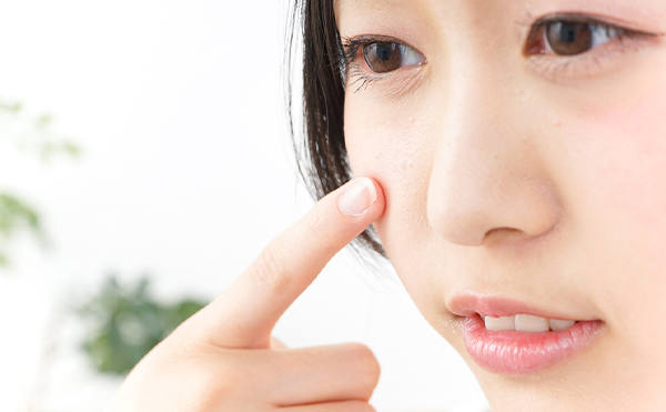 シミの予防＆対策は？透明感あふれる美肌をキープする方法