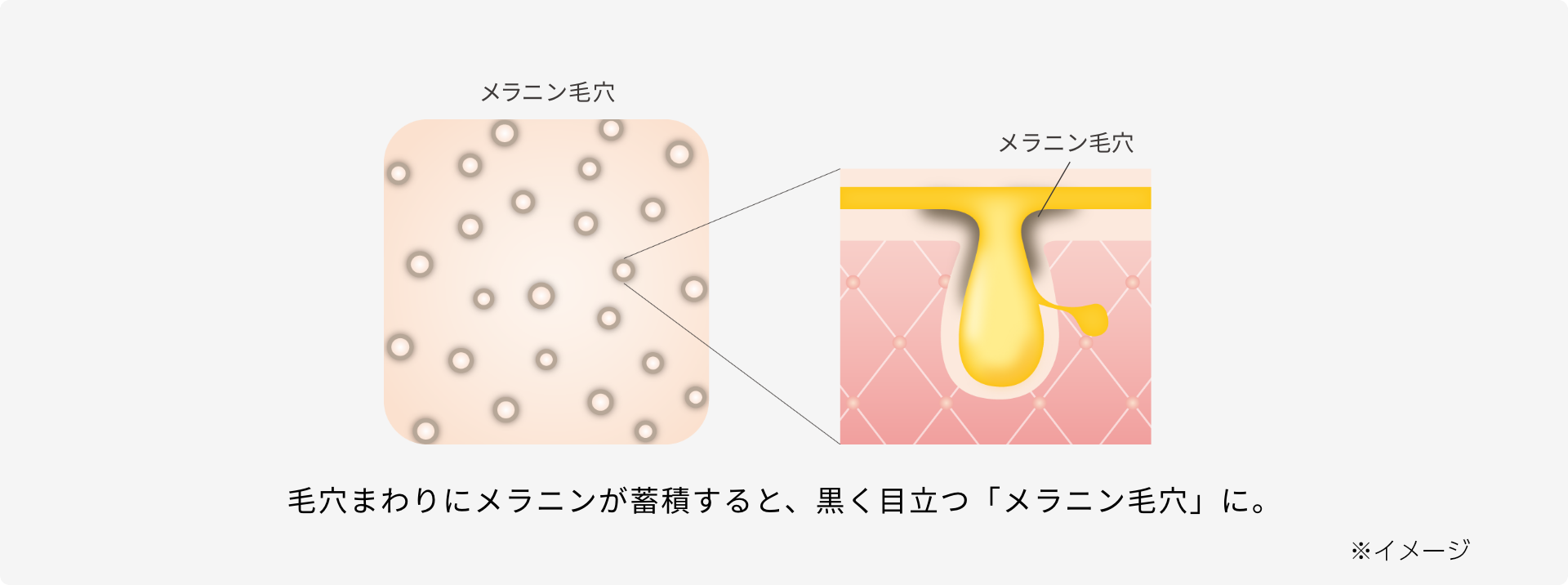 広がるシミ、濃くなるシミ、未来のシミへ。毛穴まわりのメラニンもつくらせない進化し続ける美白※ケア