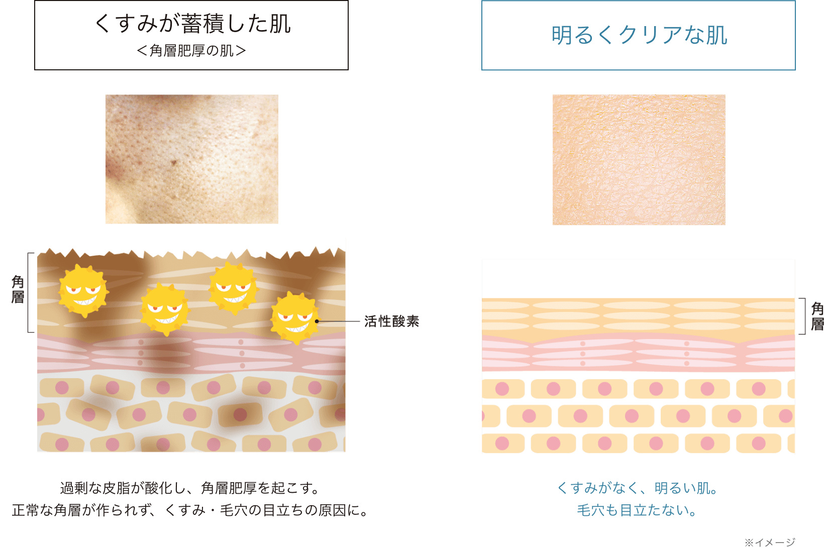 くすみが蓄積した肌 明るくクリアな肌