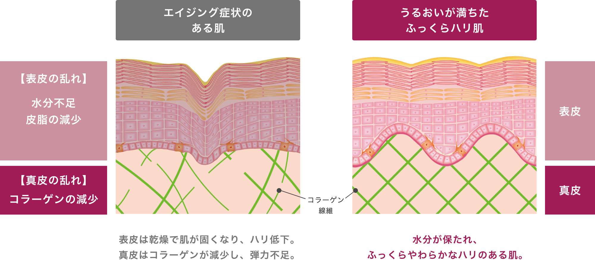 エイジング症状のある肌 うるおいが満ちたふっくらハリ肌