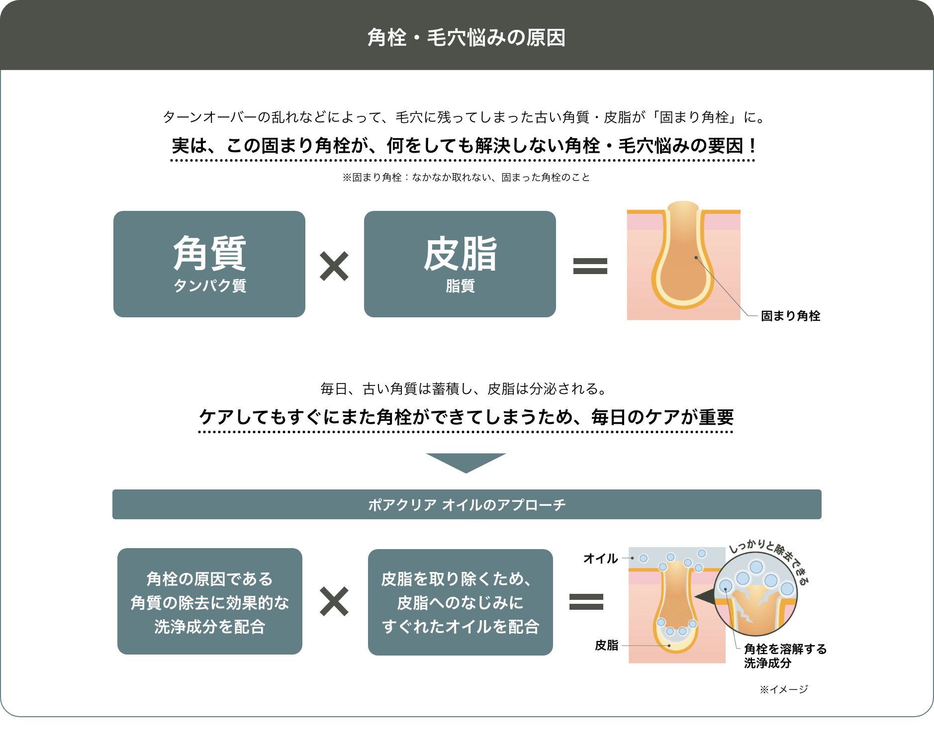 角栓・毛穴悩みの原因