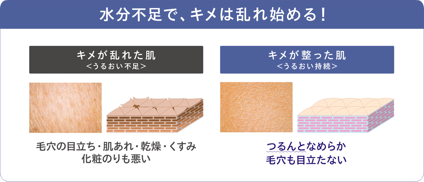 水分不足で、キメは乱れ始める!