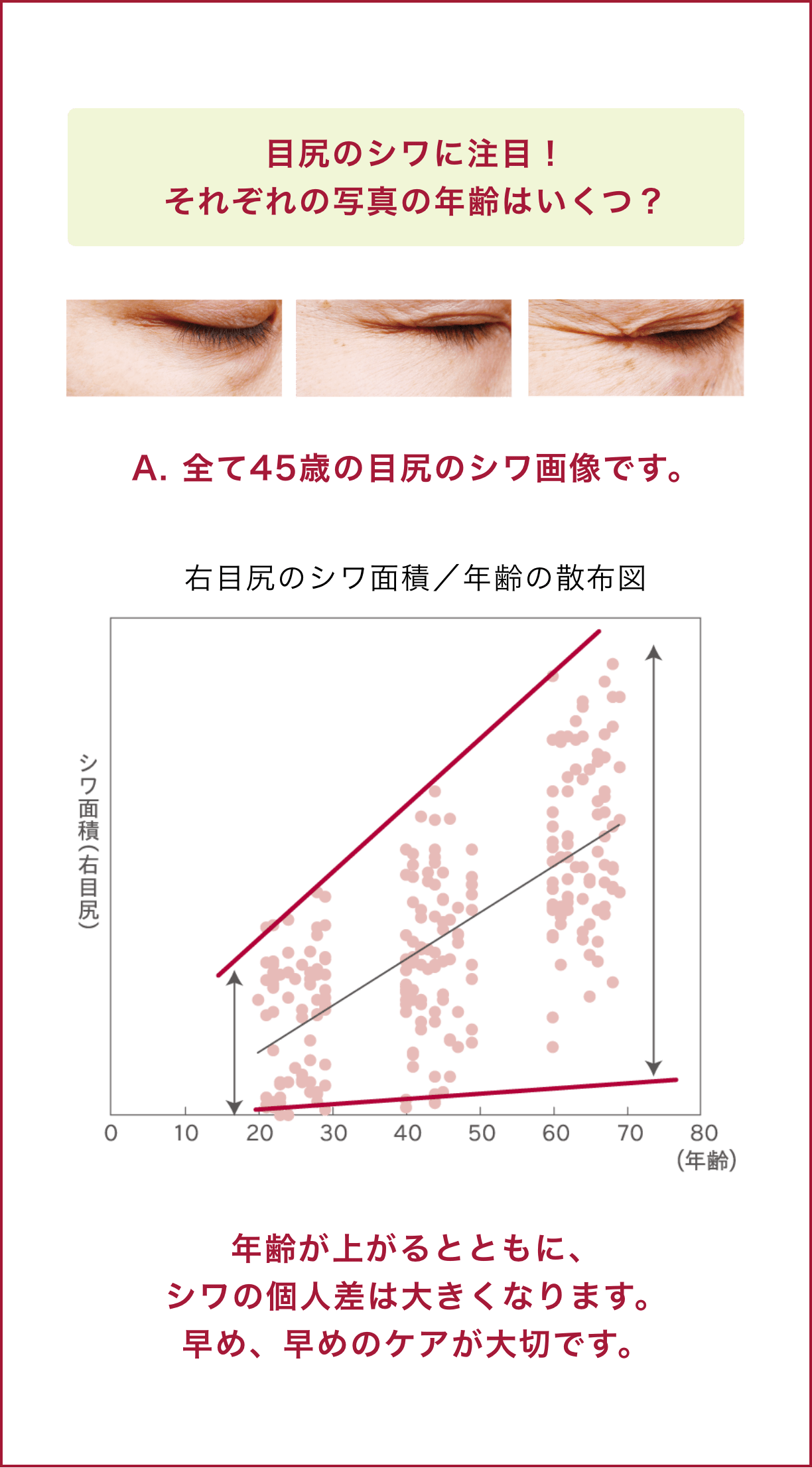 年齢が上がるとともに、シワの個人差は大きくなります。早め、早めのケアが大切です。