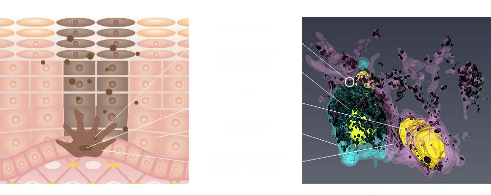 一般的な模式図と3D解析 比較図