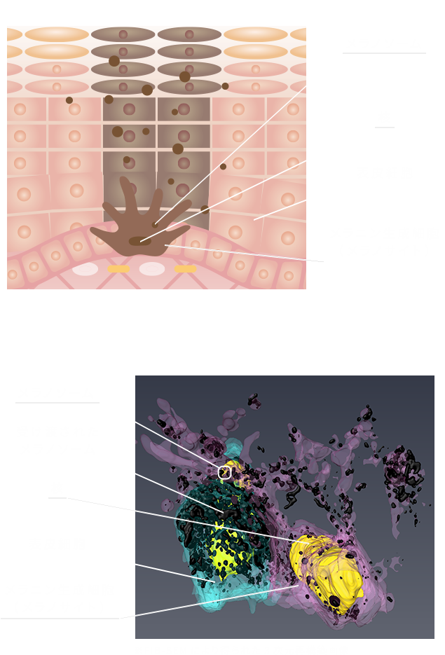 一般的な模式図と3D解析 比較図