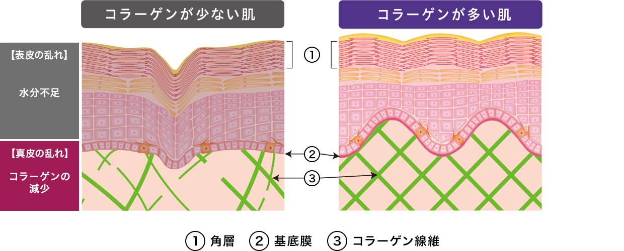 ①角質②基底膜③コラーゲン繊維