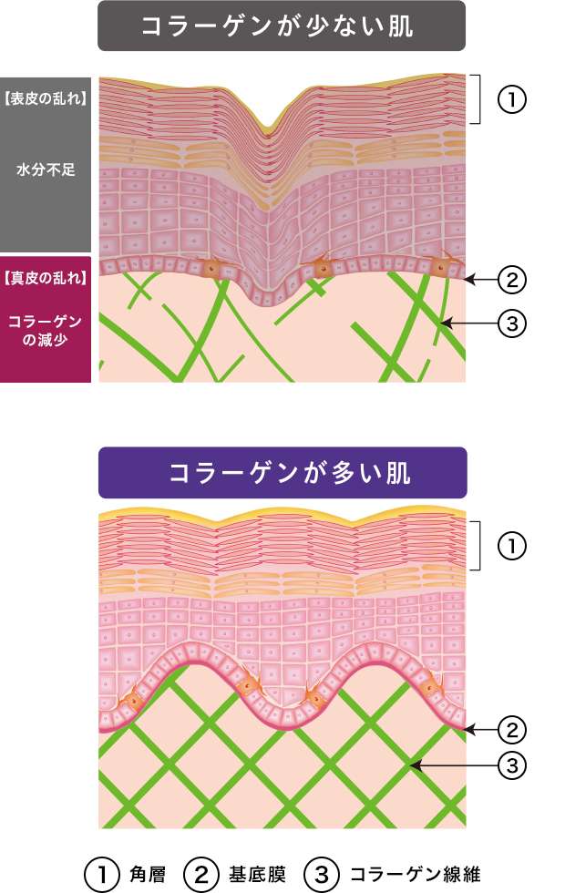 ①角質②基底膜③コラーゲン繊維