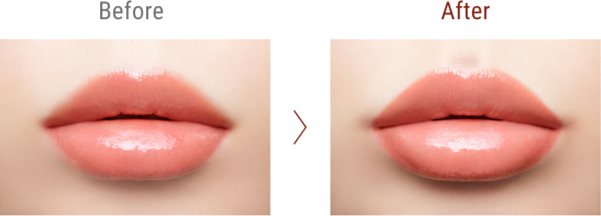 Before / After