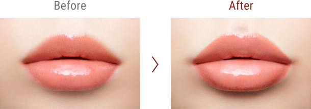 Before / After