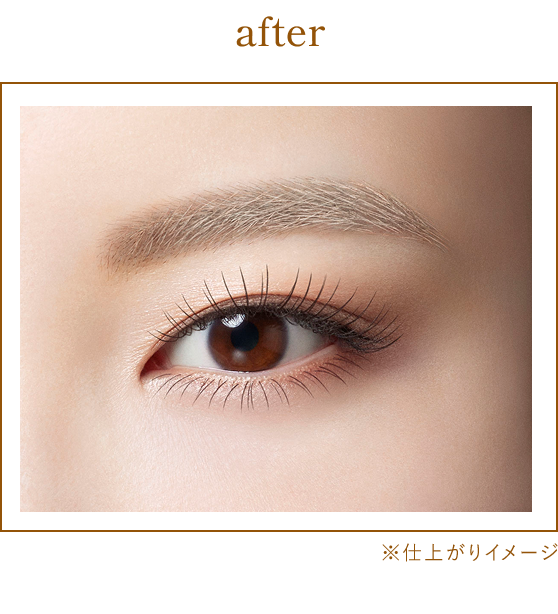 After