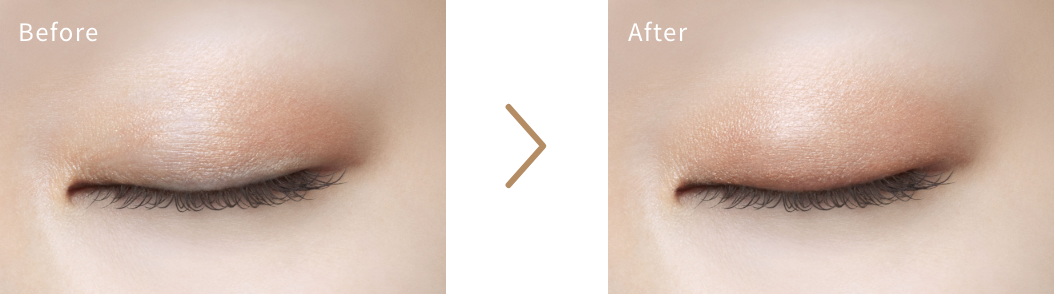 Before After