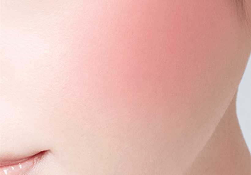 FOGGY ON CHEEKS N | Visee＜ヴィセ＞